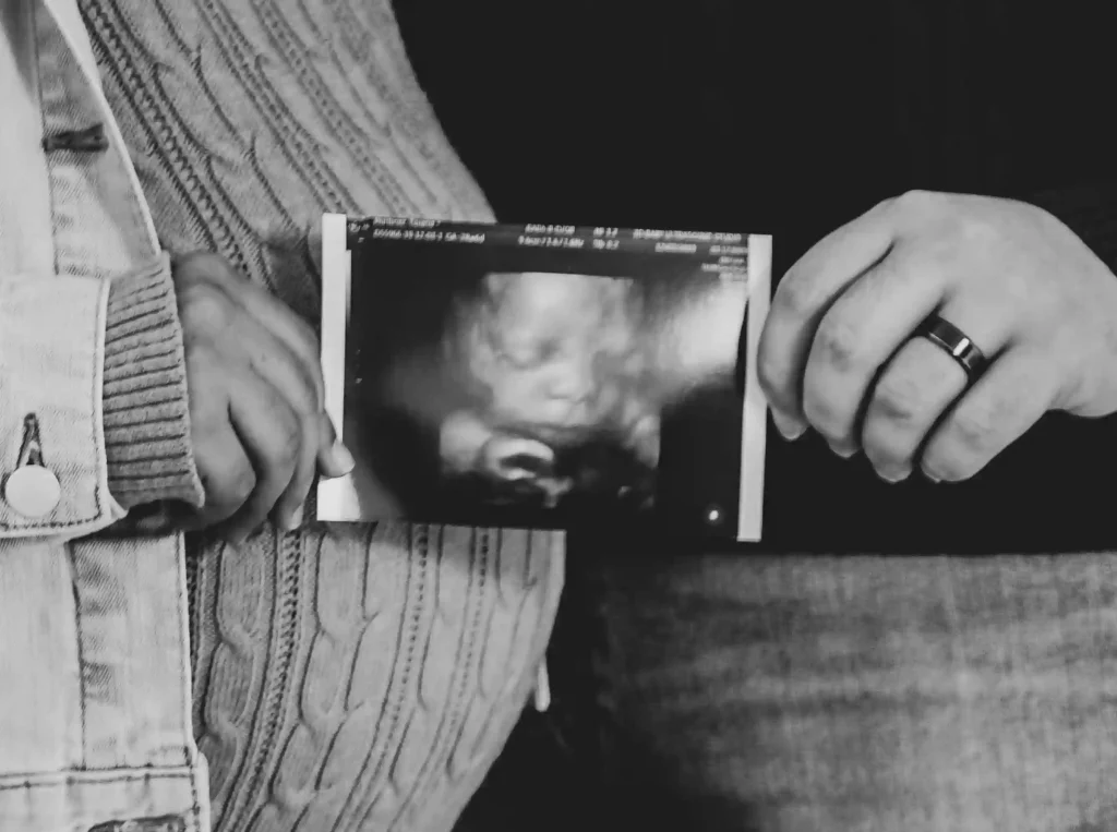 Échographie 3D d'un foetus au 3ème trimestre de la grossesse